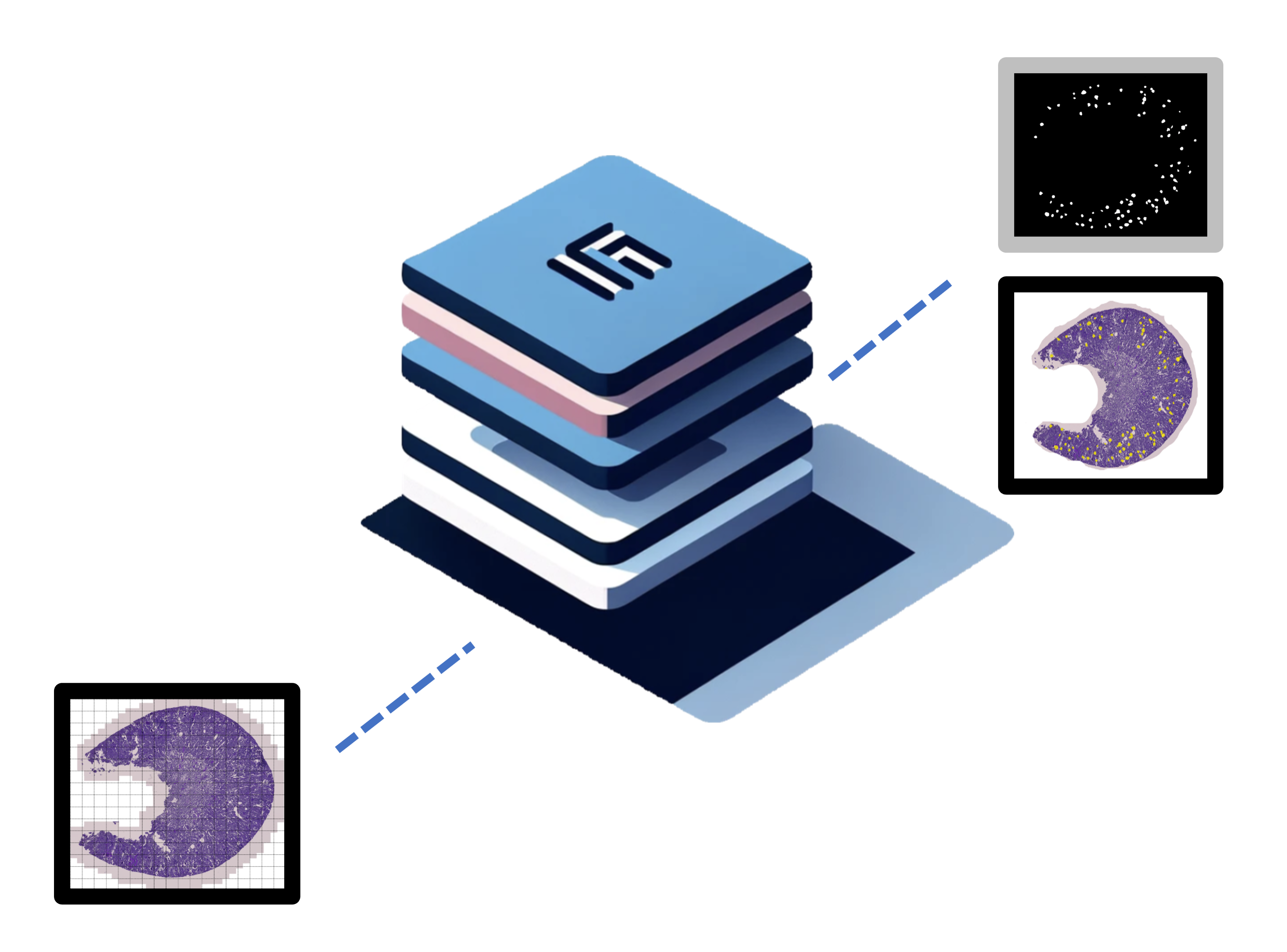 Kidney Slide Illustration